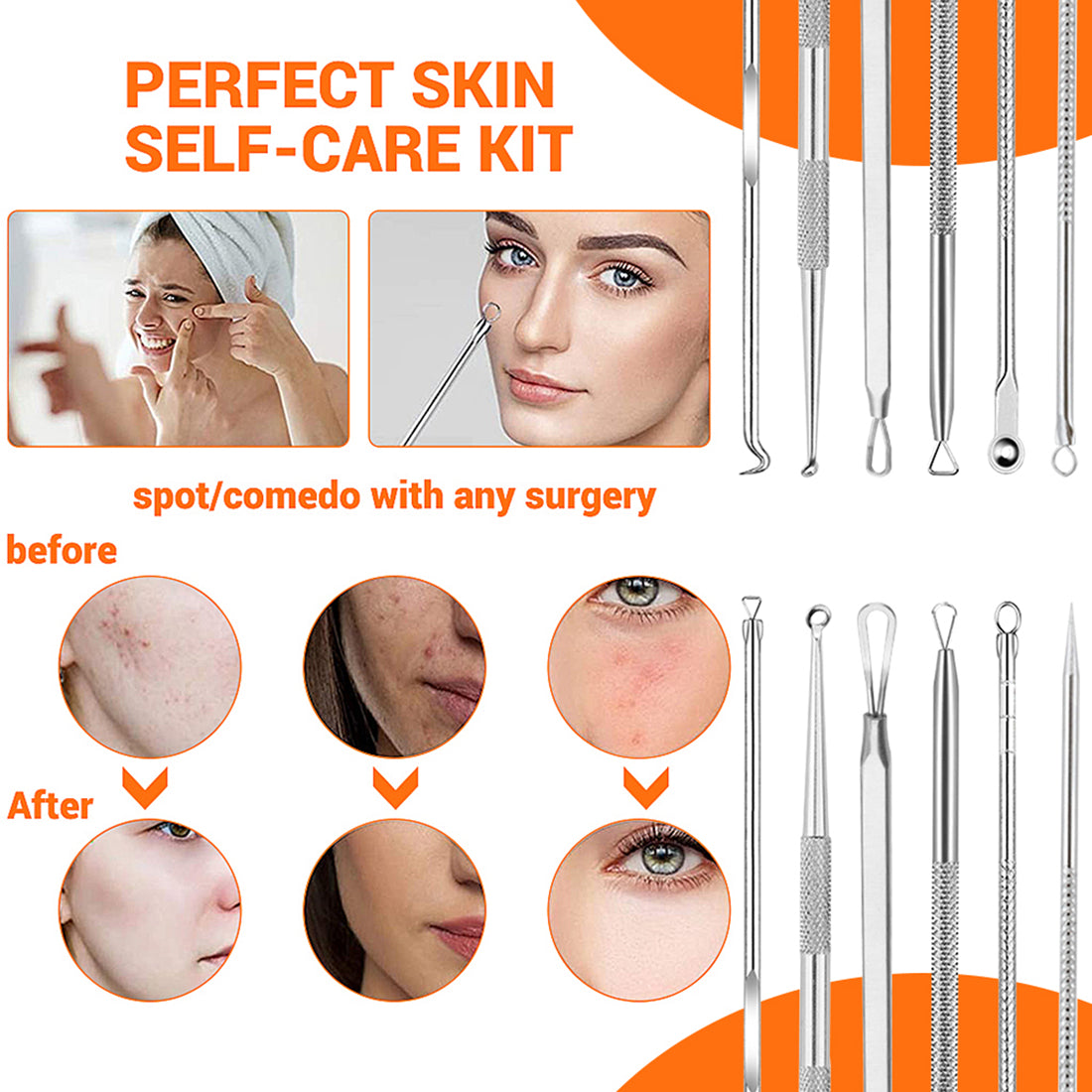 MAYCREATE 9PCS Blackhead Remover Tools Stainless Steel Blackhead Pimple Blemish Extractor/Remover Tool with Tweezers, Professional Acne Remove Tools MAYCREATE 9PCS Blackhead Remover Tools Stainless Steel Blackhead Pimple Blemish Extractor/Remover Tool with Tweezers, Professional Acne Remove Tools